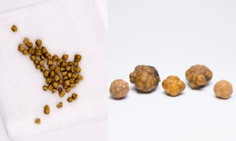 small stones